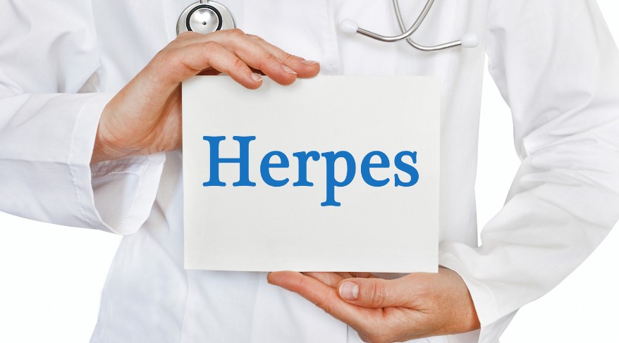 how do you get herpes