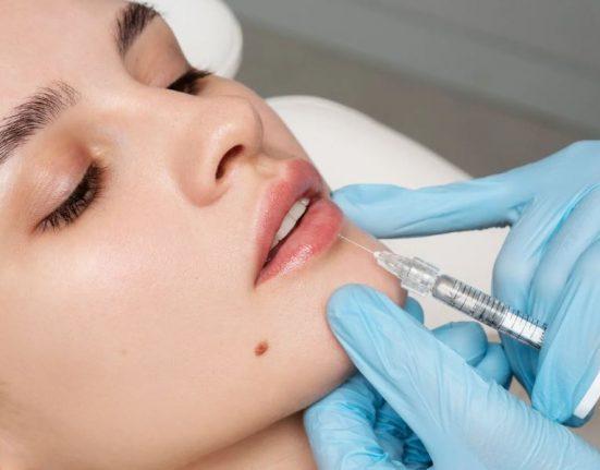 How Can a Lip Lift Transform Your Smile?